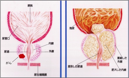 泌尿器科 診療科 Ja長野厚生連 南長野医療センター篠ノ井総合病院