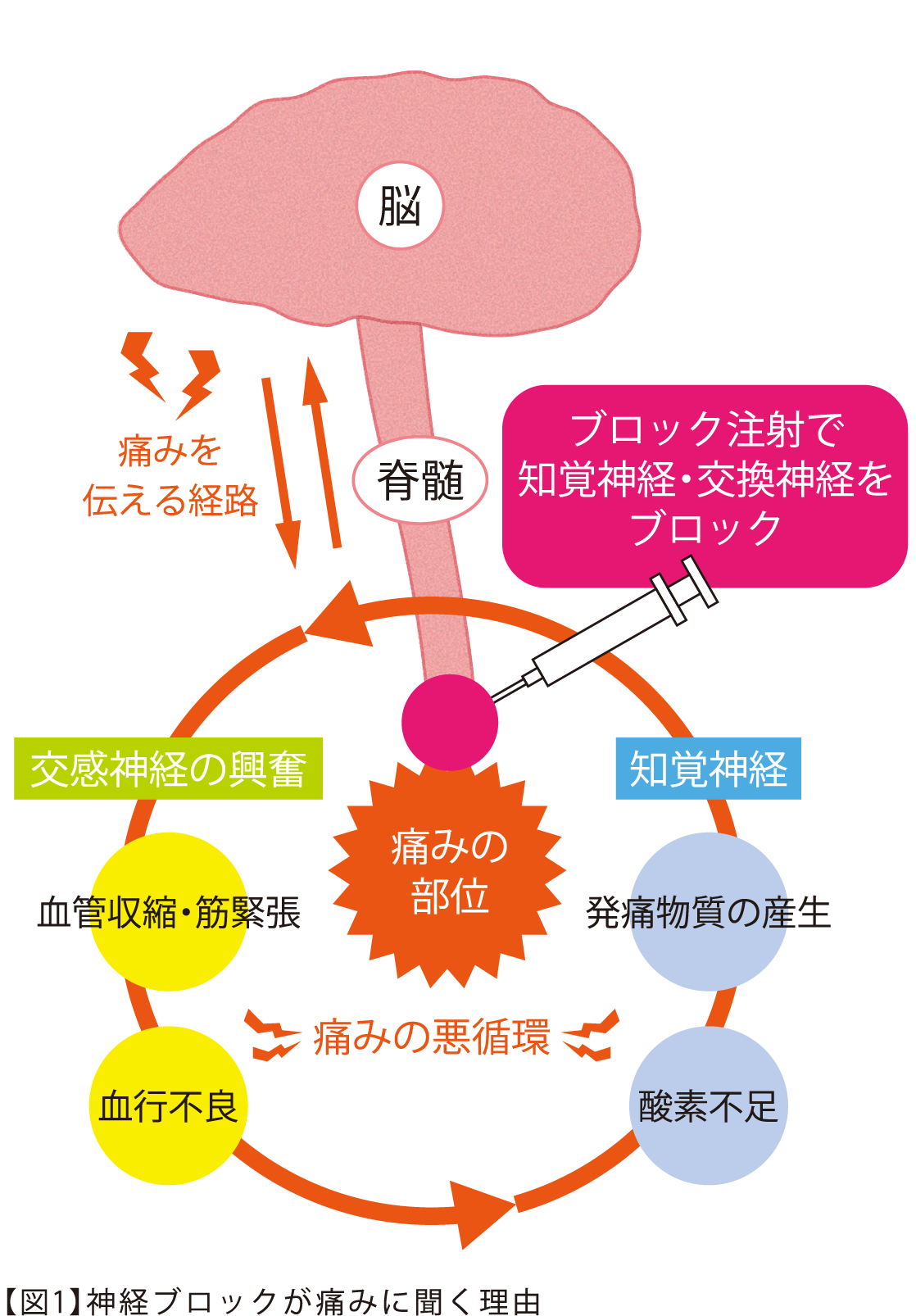 図1_神経ブロックが痛みに聞く理由